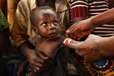 Traitement d'un enfant malnutri 